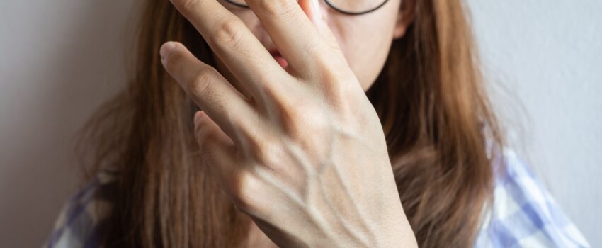 Woman holding up her hand with prominent veins on it