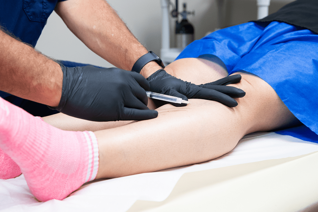 A doctor treating spider veins with an injection on a patient's leg