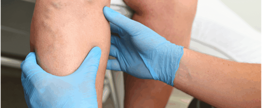 Patient having their varicose veins examined for vein stripping procedure.