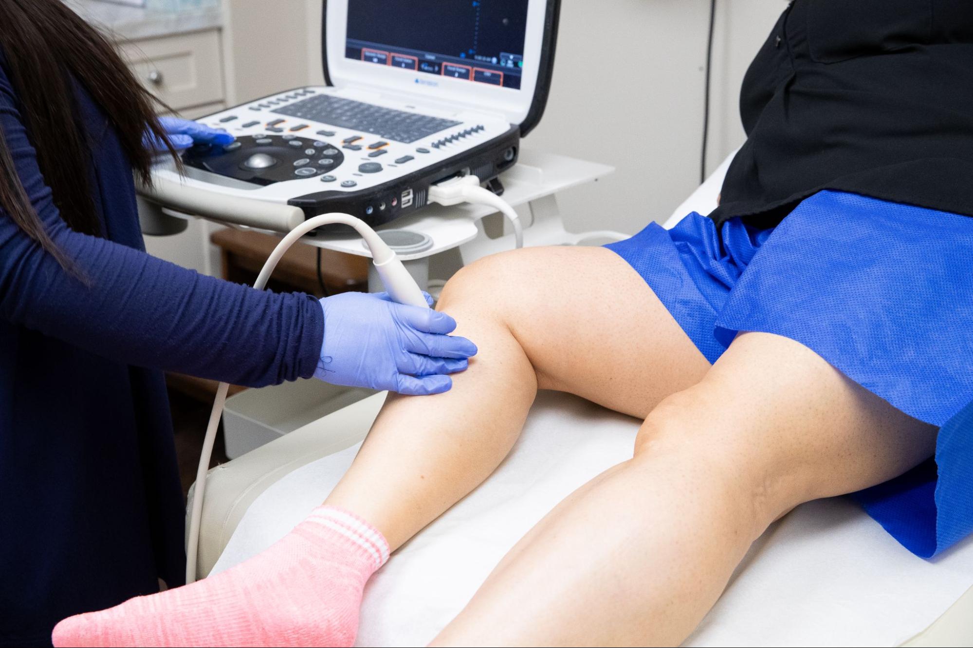 Leg vein treatment
