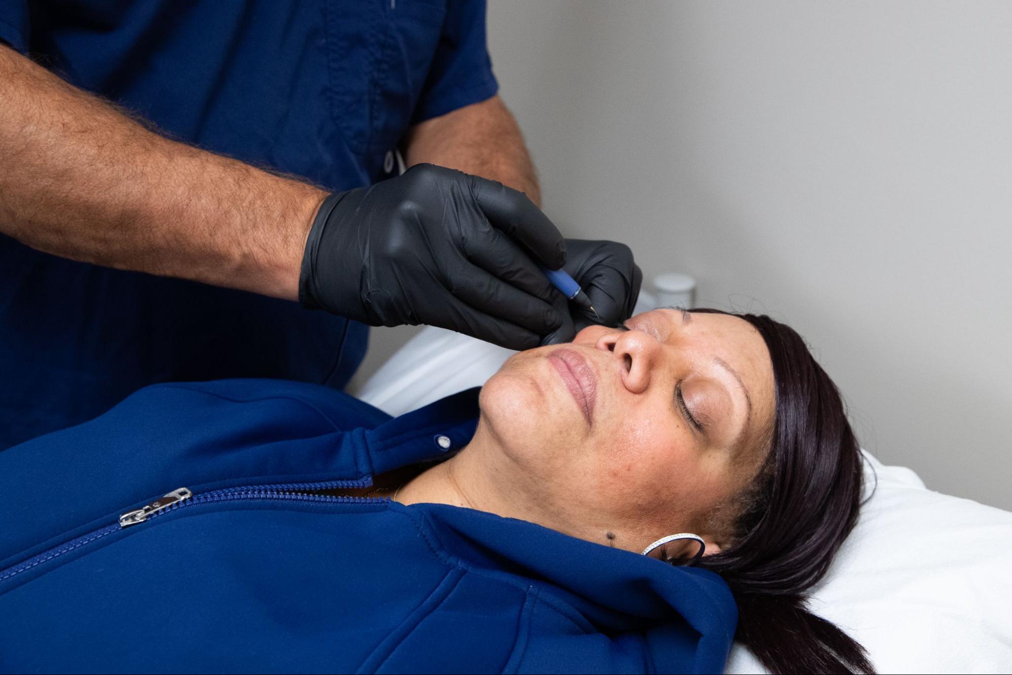 Facial vein treatment